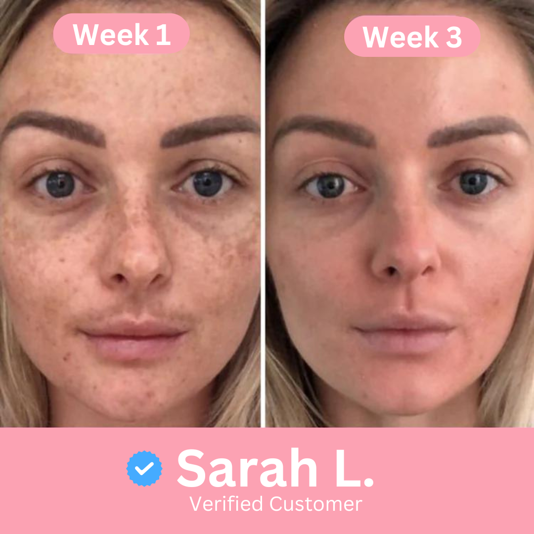 Turmeric Cleansing Pads NEW