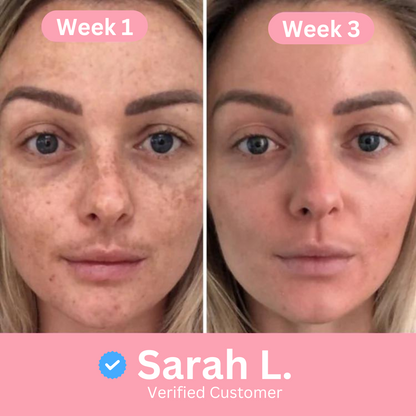 Turmeric Cleansing Pads NEW