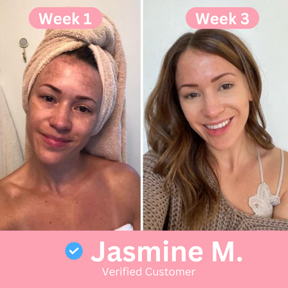 Turmeric Cleansing Pads NEW